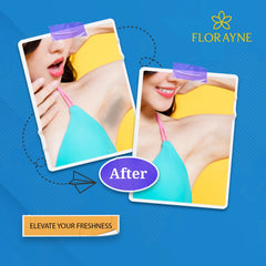 Florayne Underarm Roll-On – Odour Control & Brightening Care